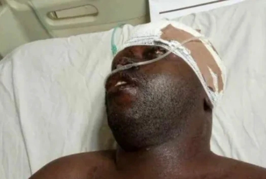 RELIGION: Members Beat Pastor To Coma After He Asked Them To Pay ₦16,000 To Unlock 2022