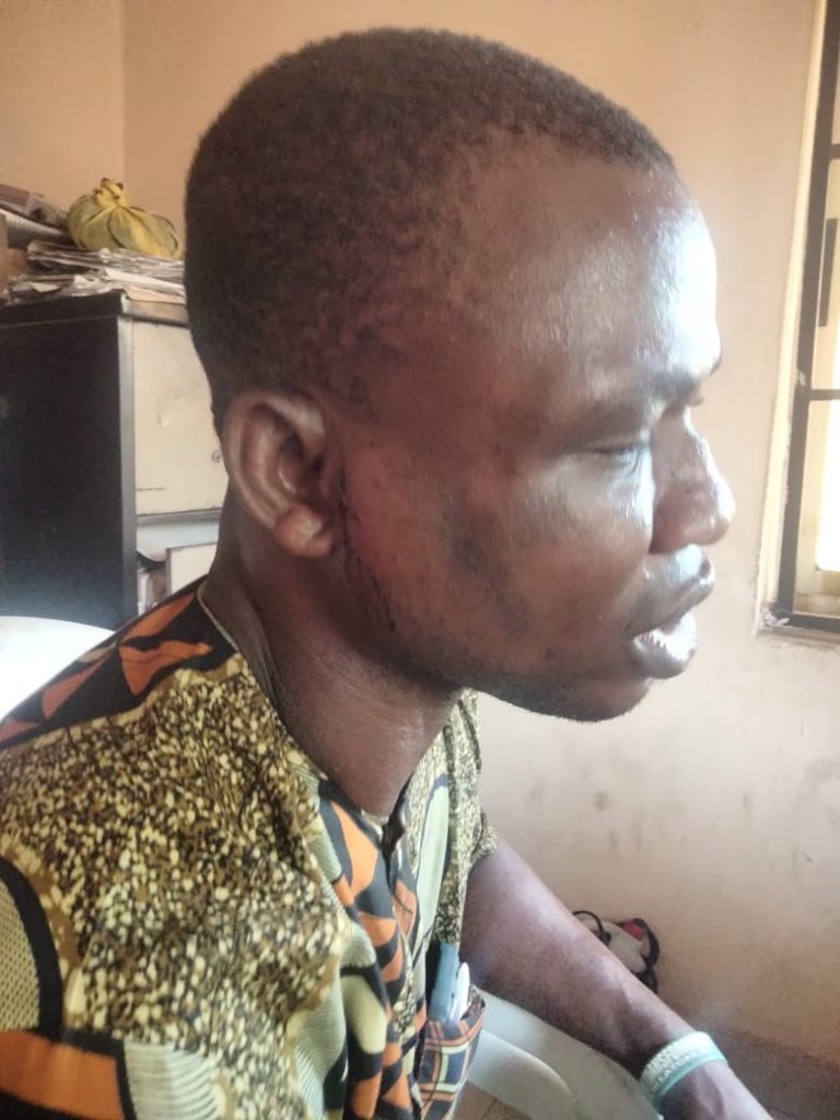 Sagamu: RYA Sport Director, Adetayo Olufemi, Escapes Robbery Attack In Ogijo By Mob Allegedly Reported To Be Cultists, Get Injure, Destroy Car, Seeks Public Intervention For Justice